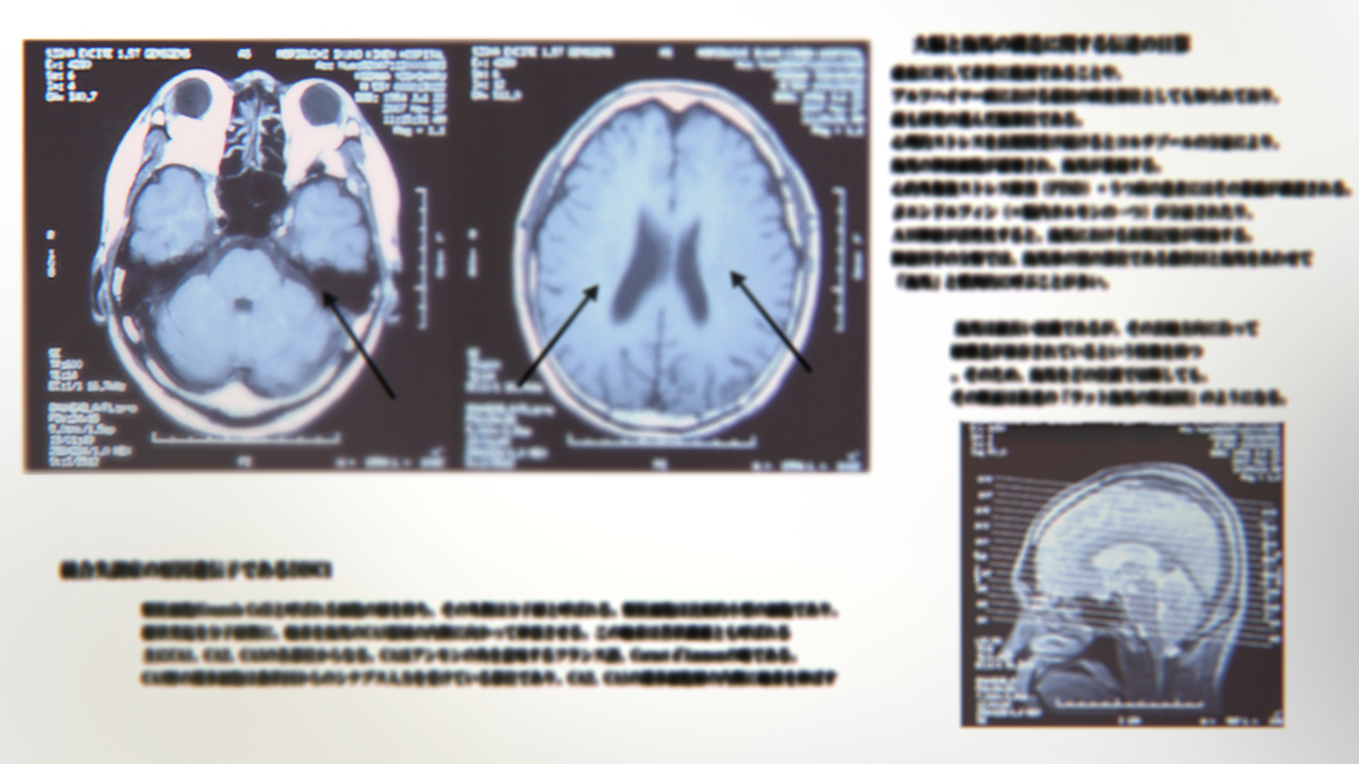 Brain scan MRI research — Neuroscience Department Viktor Chondria University